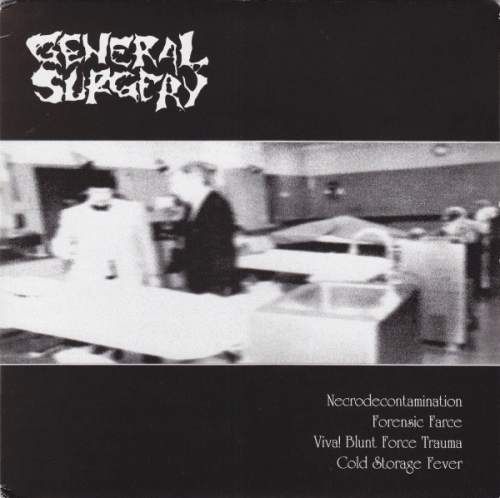 General Surgery : General Surgery - Machetazo